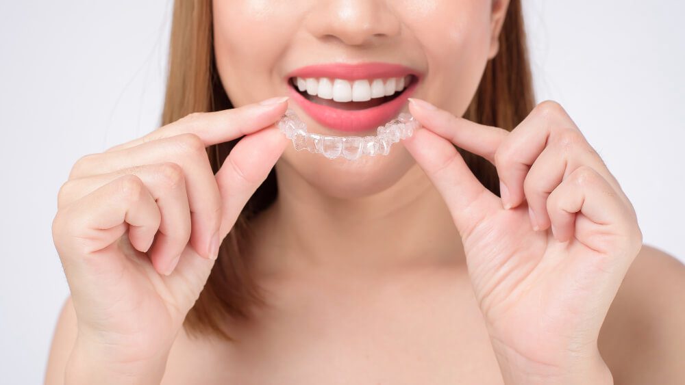 Evolución del tratamiento Invisalign paso a paso
