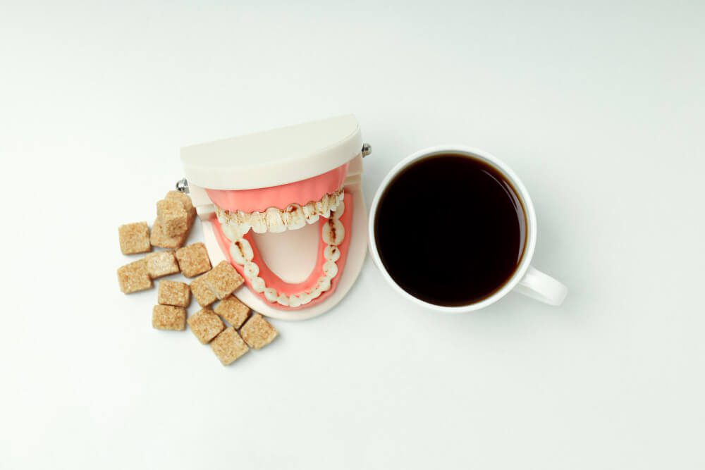 Quitar manchas en los dientes: soluciones efectivas