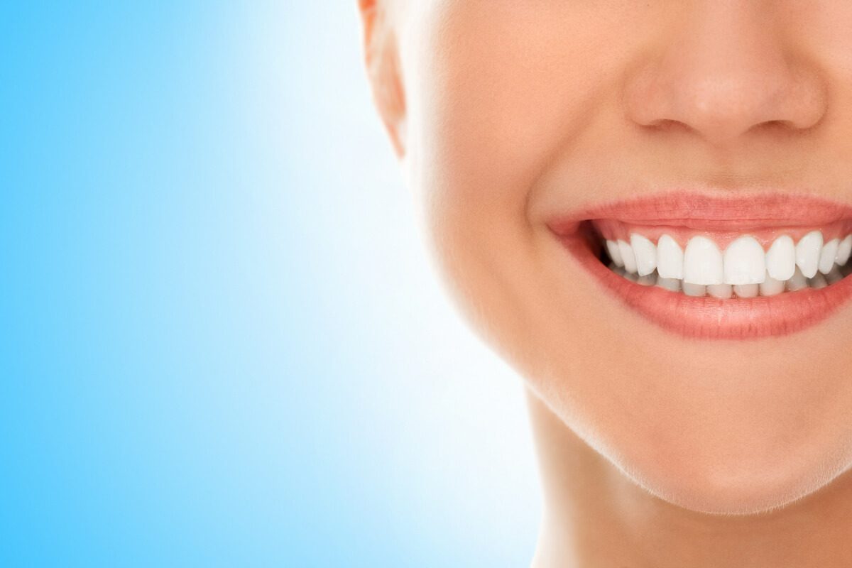 ¿El blanqueamiento dental cuánto dura?