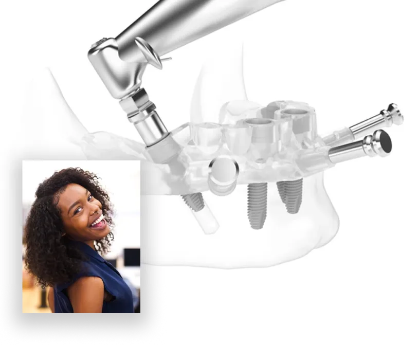 composicion-protesis-2 Composición de imagenes de prótesis