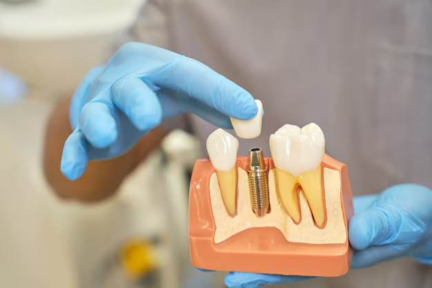 Cuidados después de implantes dentales: guía completa para una recuperación segura y duradera